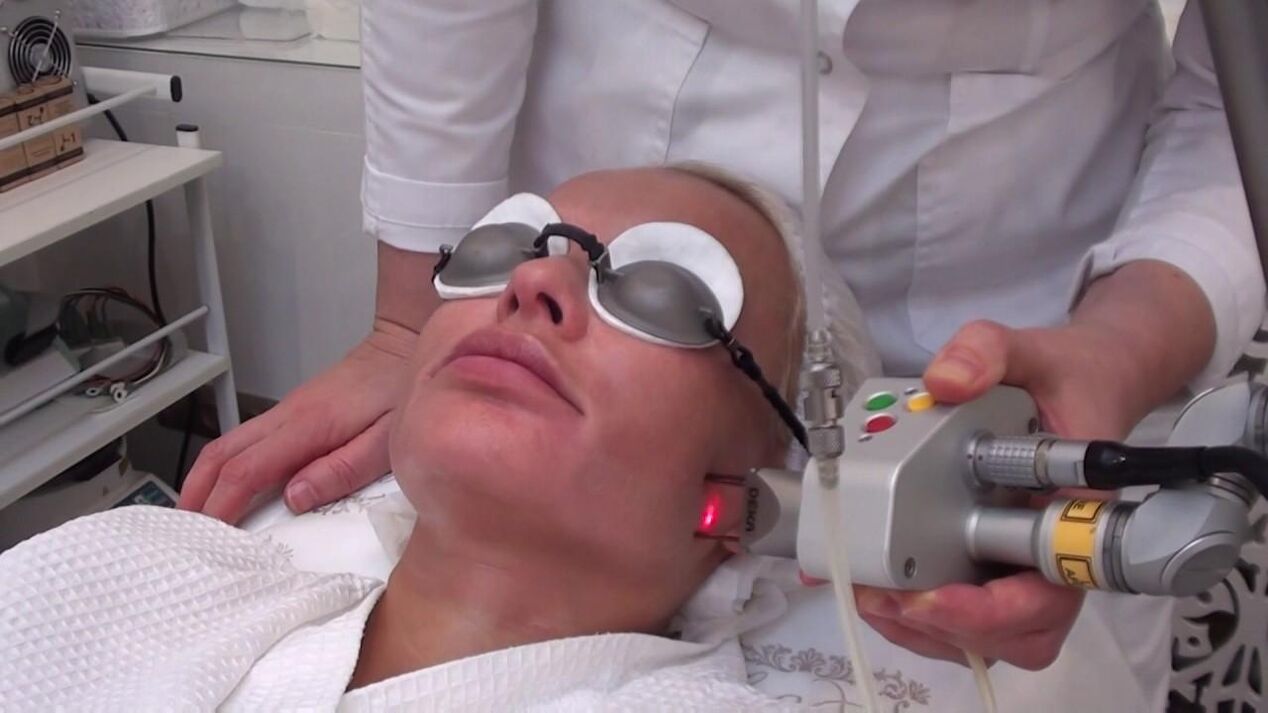 Treatment with a laser beam of problem areas of the skin of the face